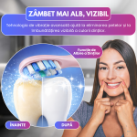 Periuta de dinti electrica sonica RAPAZ® SmilePro V8pro, 48000Hz, Autonomie 360 zile, Roz - imagine 2