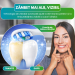 Periuta de dinti electrica sonica RAPAZ® SmilePro V8pro, 48000Hz, Autonomie 360 zile, Alb - imagine 3
